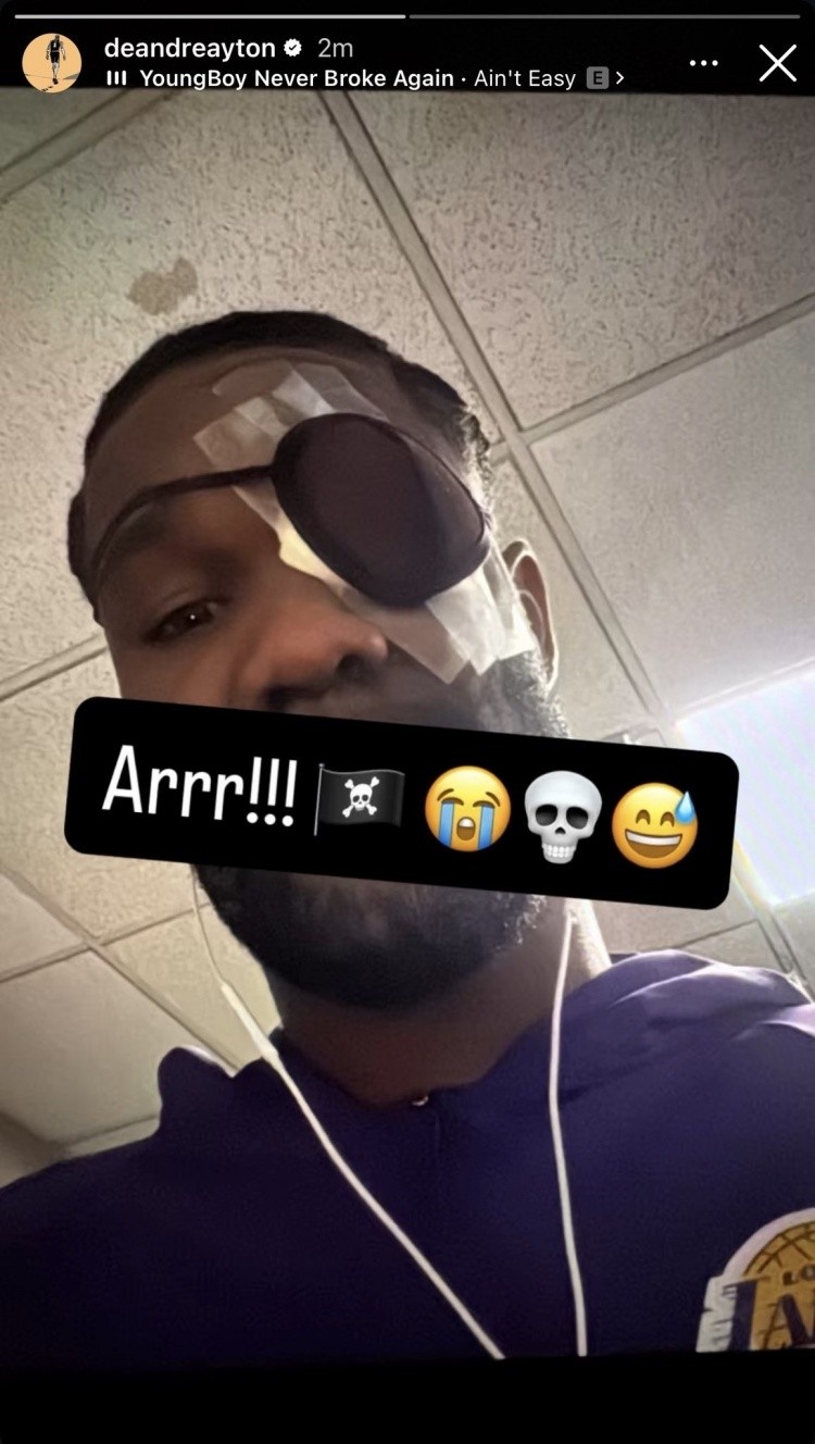 九游官网主页-明日洛杉矶德比 艾顿可以出战！里夫斯与蒂耶罗继续缺席